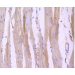 Anti-ROCK-1 Antibody from Bioworld Technology (BS9946M) - Antibodies.com