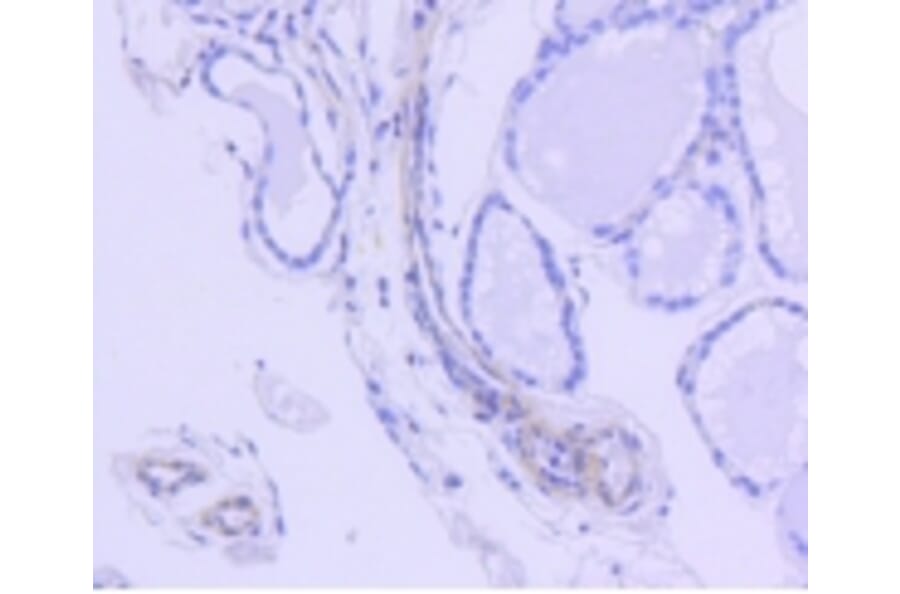 Anti-ROCK-1 Antibody from Bioworld Technology (BS9946M) - Antibodies.com