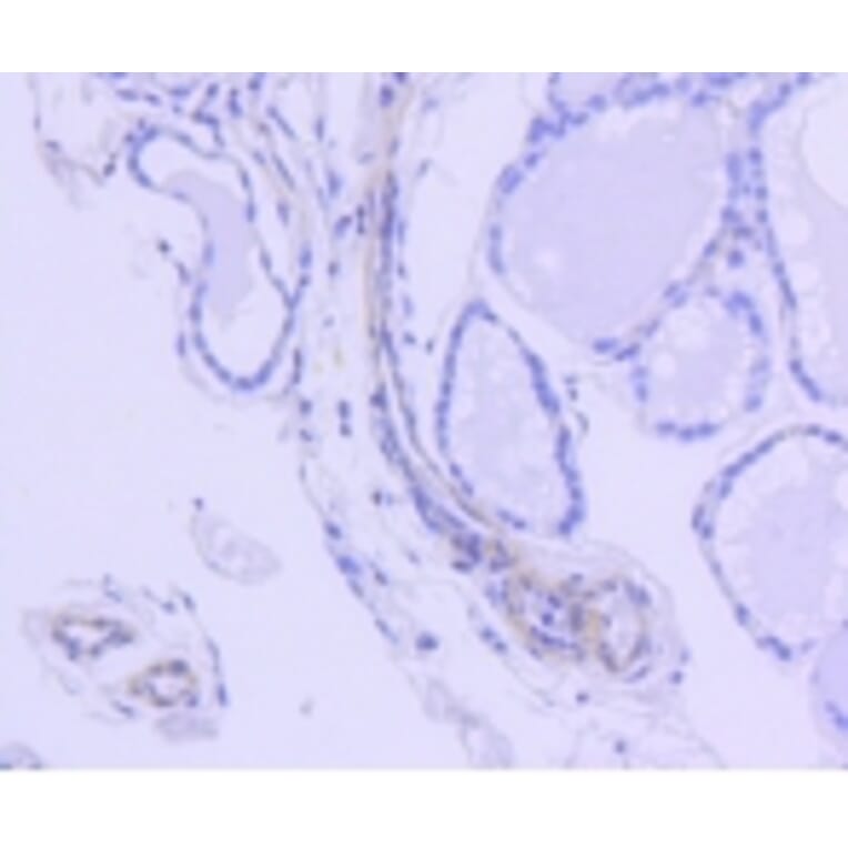 Anti-ROCK-1 Antibody from Bioworld Technology (BS9946M) - Antibodies.com