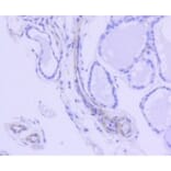 Anti-ROCK-1 Antibody from Bioworld Technology (BS9946M) - Antibodies.com