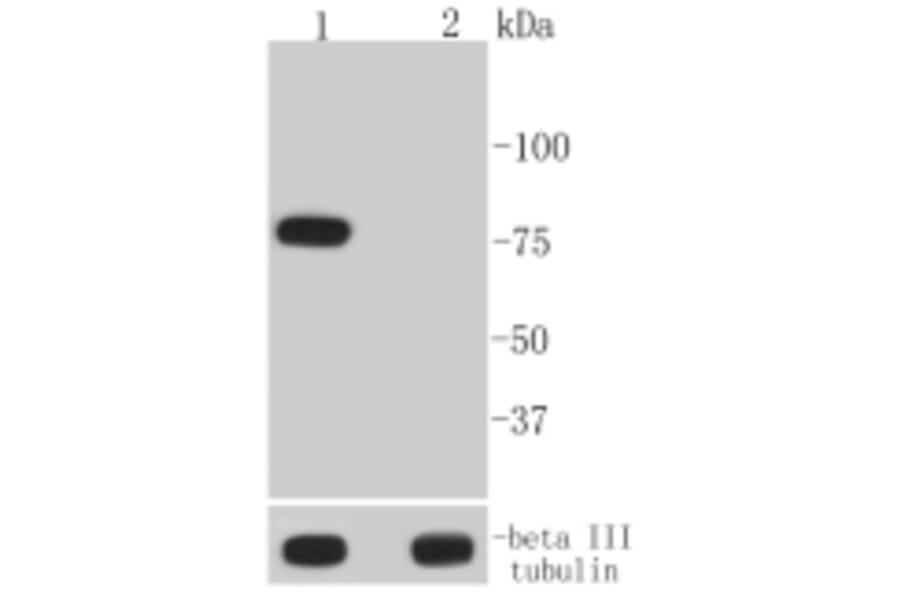Anti-BTK (phospho-Y223) Antibody from Bioworld Technology (BS9948M) - Antibodies.com