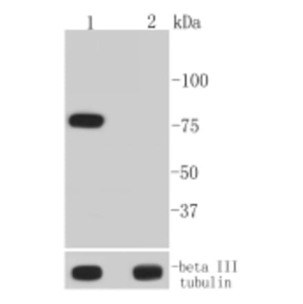 Anti-BTK (phospho-Y223) Antibody from Bioworld Technology (BS9948M) - Antibodies.com