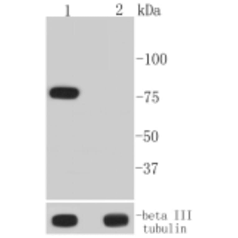 Anti-BTK (phospho-Y223) Antibody from Bioworld Technology (BS9948M) - Antibodies.com