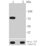 Anti-BTK (phospho-Y223) Antibody from Bioworld Technology (BS9948M) - Antibodies.com