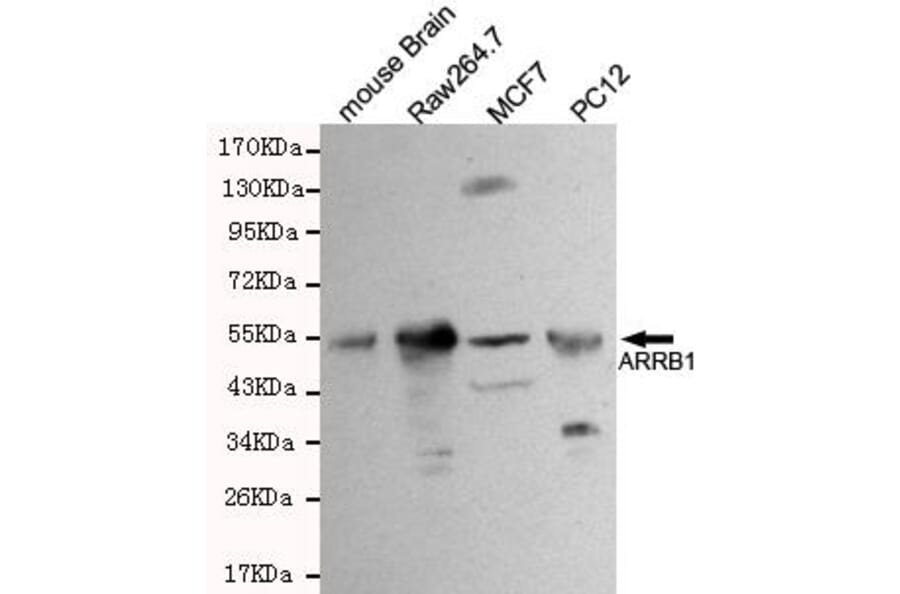 Anti-Arrestin-β-1 Antibody from Bioworld Technology (MB0001) - Antibodies.com