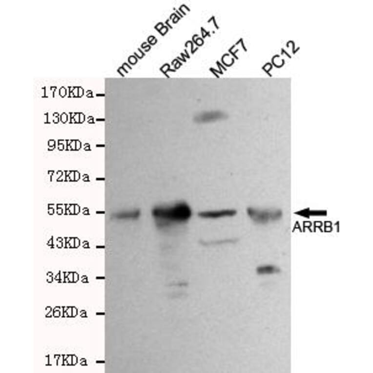 Anti-Arrestin-β-1 Antibody from Bioworld Technology (MB0001) - Antibodies.com