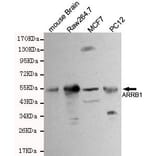 Anti-Arrestin-β-1 Antibody from Bioworld Technology (MB0001) - Antibodies.com