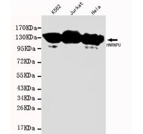 Anti-HNRNPU Antibody from Bioworld Technology (MB0002) - Antibodies.com