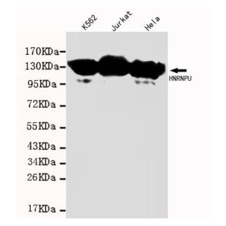 Anti-HNRNPU Antibody from Bioworld Technology (MB0002) - Antibodies.com