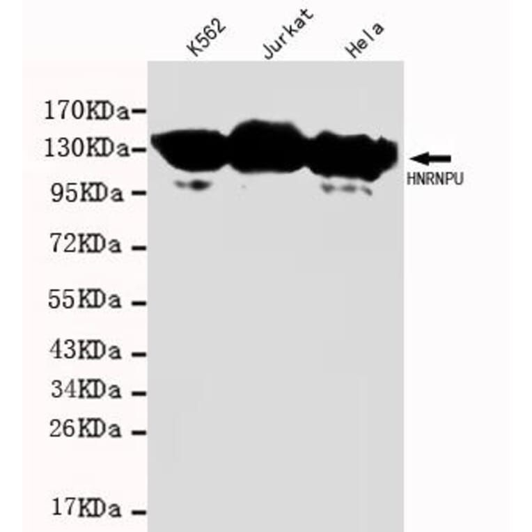 Anti-HNRNPU Antibody from Bioworld Technology (MB0002) - Antibodies.com