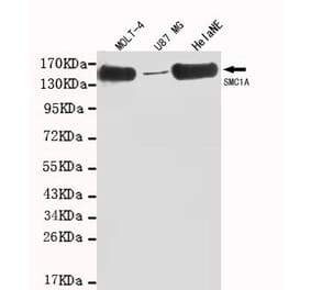 Anti-SMC1A (C-terminus) Antibody from Bioworld Technology (MB0008) - Antibodies.com