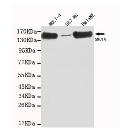 Anti-SMC1A (C-terminus) Antibody from Bioworld Technology (MB0008) - Antibodies.com
