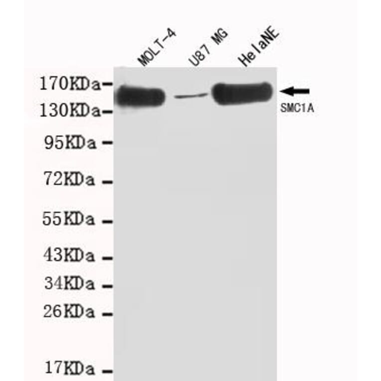 Anti-SMC1A (C-terminus) Antibody from Bioworld Technology (MB0008) - Antibodies.com