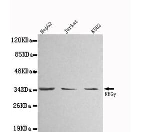 Anti-PSME3 Antibody from Bioworld Technology (MB0010) - Antibodies.com