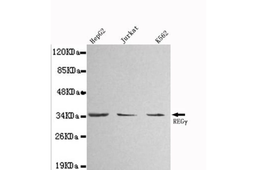 Anti-PSME3 Antibody from Bioworld Technology (MB0010) - Antibodies.com