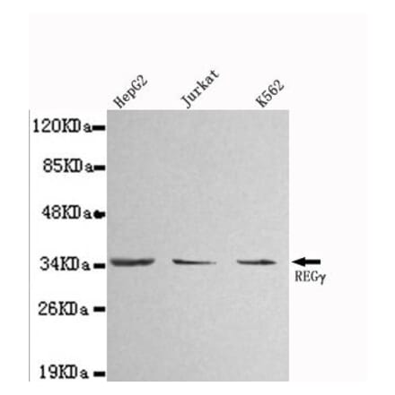 Anti-PSME3 Antibody from Bioworld Technology (MB0010) - Antibodies.com