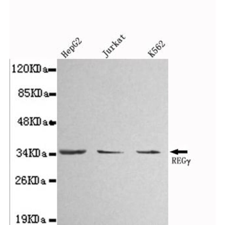 Anti-PSME3 Antibody from Bioworld Technology (MB0010) - Antibodies.com