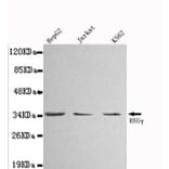 Anti-PSME3 Antibody from Bioworld Technology (MB0010) - Antibodies.com