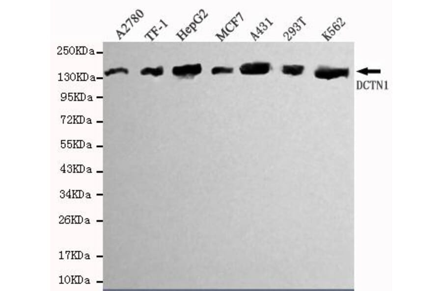 Anti-Dynactin 1 (N-terminus) Antibody from Bioworld Technology (MB0011) - Antibodies.com