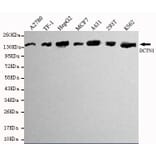 Anti-Dynactin 1 (N-terminus) Antibody from Bioworld Technology (MB0011) - Antibodies.com