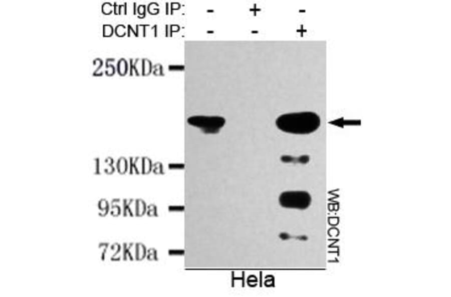 Anti-Dynactin 1 (N-terminus) Antibody from Bioworld Technology (MB0011) - Antibodies.com