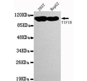Anti-TRIM28 (C-terminus) Antibody from Bioworld Technology (MB0014) - Antibodies.com