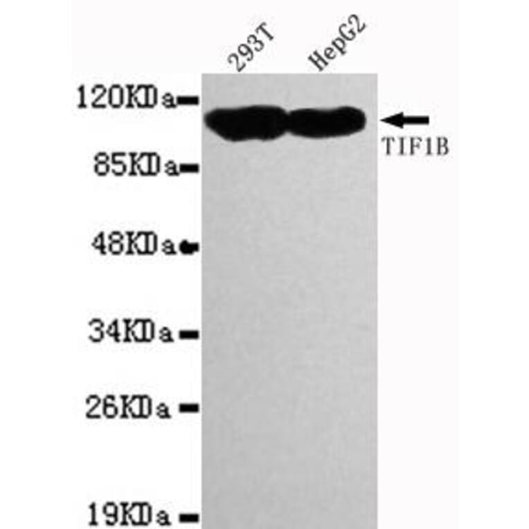 Anti-TRIM28 (C-terminus) Antibody from Bioworld Technology (MB0014) - Antibodies.com