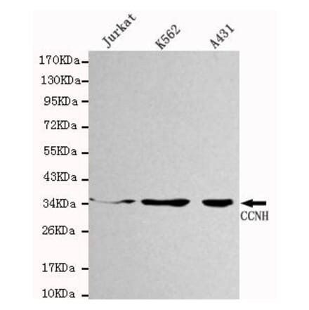 Anti-Cyclin H Antibody from Bioworld Technology (MB0018) - Antibodies.com