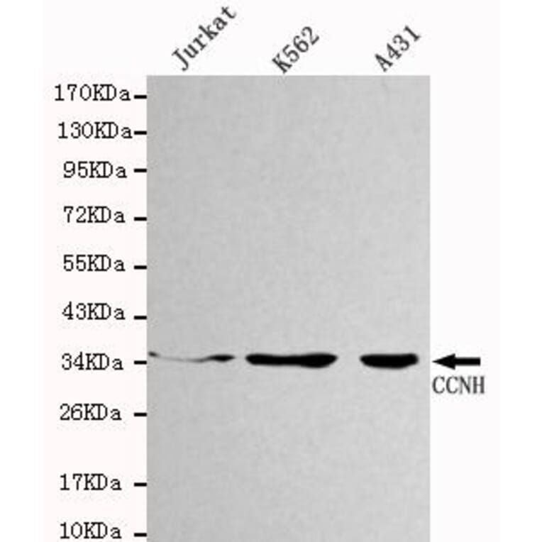 Anti-Cyclin H Antibody from Bioworld Technology (MB0018) - Antibodies.com