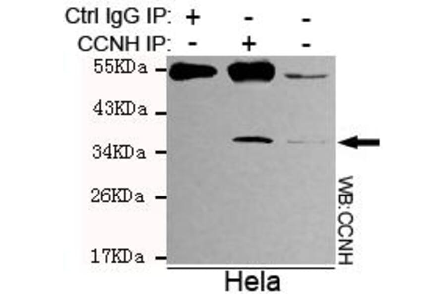 Anti-Cyclin H Antibody from Bioworld Technology (MB0018) - Antibodies.com