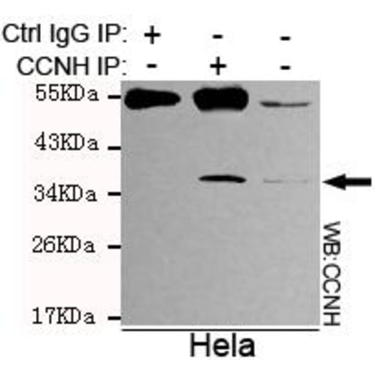 Anti-Cyclin H Antibody from Bioworld Technology (MB0018) - Antibodies.com