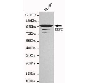 Anti-EEF2 Antibody from Bioworld Technology (MB0020) - Antibodies.com