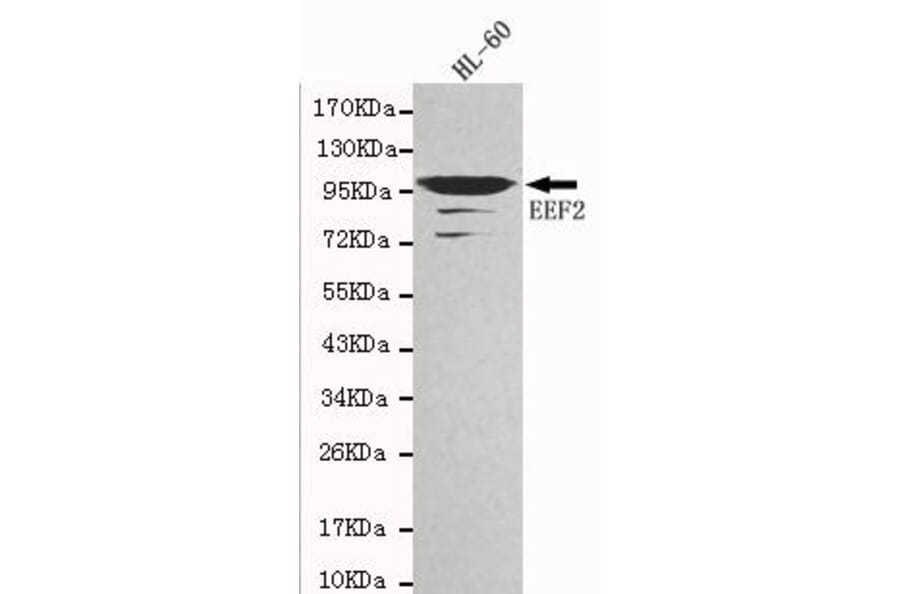 Anti-EEF2 Antibody from Bioworld Technology (MB0020) - Antibodies.com