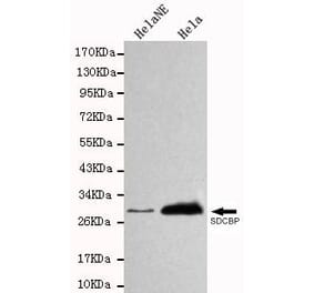 Anti-SDCBP Antibody from Bioworld Technology (MB0021) - Antibodies.com