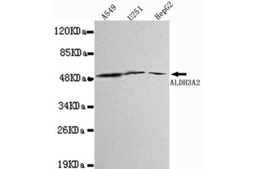 Anti-ALDH3A2 Antibody from Bioworld Technology (MB0022) - Antibodies.com