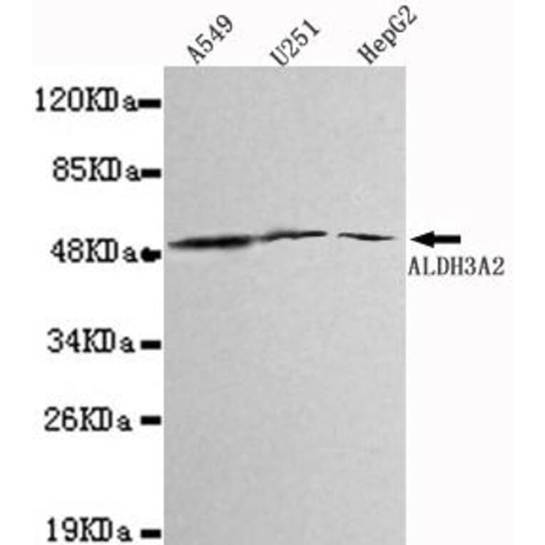 Anti-ALDH3A2 Antibody from Bioworld Technology (MB0022) - Antibodies.com