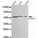 Anti-ALDH3A2 Antibody from Bioworld Technology (MB0022) - Antibodies.com