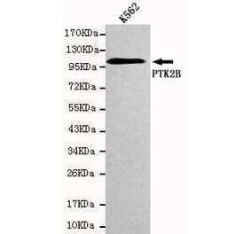 Anti-PYK2 Antibody from Bioworld Technology (MB0023) - Antibodies.com
