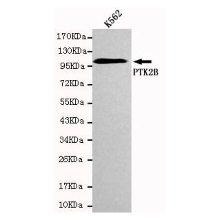Anti-PYK2 Antibody from Bioworld Technology (MB0023) - Antibodies.com