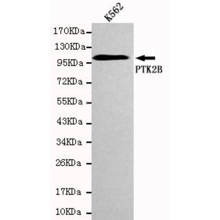 Anti-PYK2 Antibody from Bioworld Technology (MB0023) - Antibodies.com