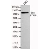 Anti-PYK2 Antibody from Bioworld Technology (MB0023) - Antibodies.com