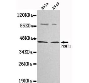 Anti-PRMT1 Antibody from Bioworld Technology (MB0025) - Antibodies.com