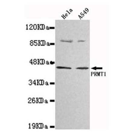 Anti-PRMT1 Antibody from Bioworld Technology (MB0025) - Antibodies.com