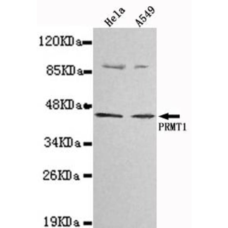 Anti-PRMT1 Antibody from Bioworld Technology (MB0025) - Antibodies.com