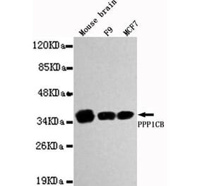 Anti-PPP1CB Antibody from Bioworld Technology (MB0026) - Antibodies.com