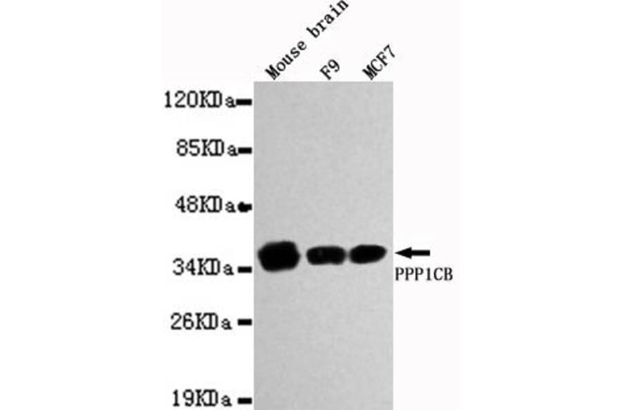 Anti-PPP1CB Antibody from Bioworld Technology (MB0026) - Antibodies.com