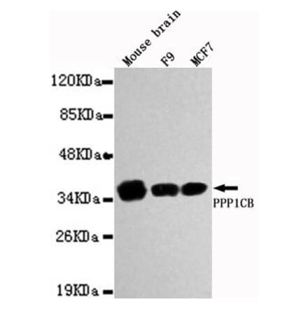 Anti-PPP1CB Antibody from Bioworld Technology (MB0026) - Antibodies.com