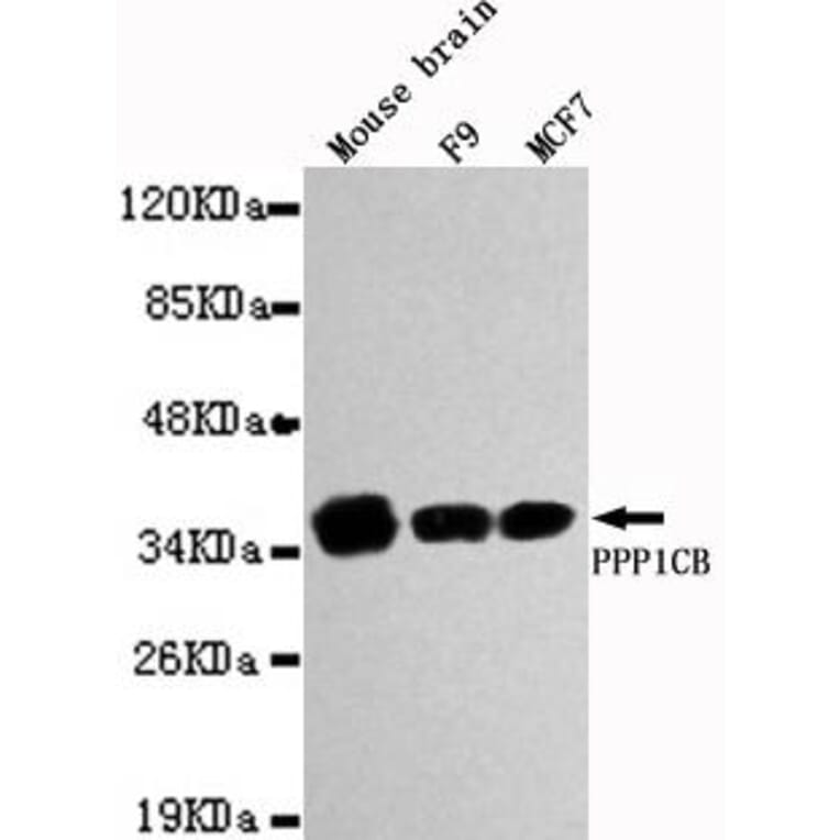 Anti-PPP1CB Antibody from Bioworld Technology (MB0026) - Antibodies.com