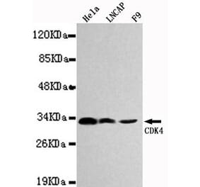Anti-CDK4 Antibody from Bioworld Technology (MB0027) - Antibodies.com