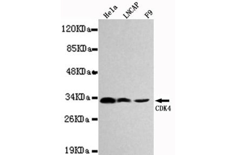 Anti-CDK4 Antibody from Bioworld Technology (MB0027) - Antibodies.com